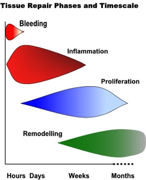 tissue-repair-phases