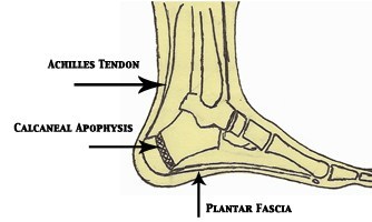 severs-disease-anatomy