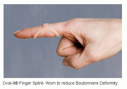 finger-splint