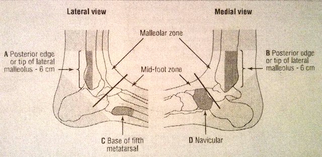 ottawa-ankle-rule