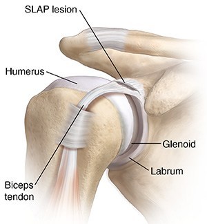 slap-lesion-anatomy