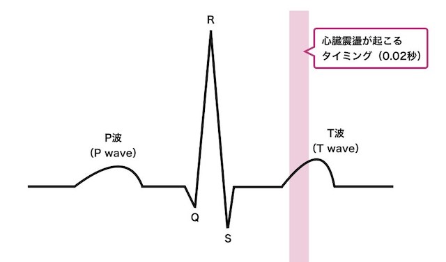 commotio-cordis-diagram