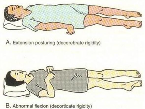 posture-of-movement-function